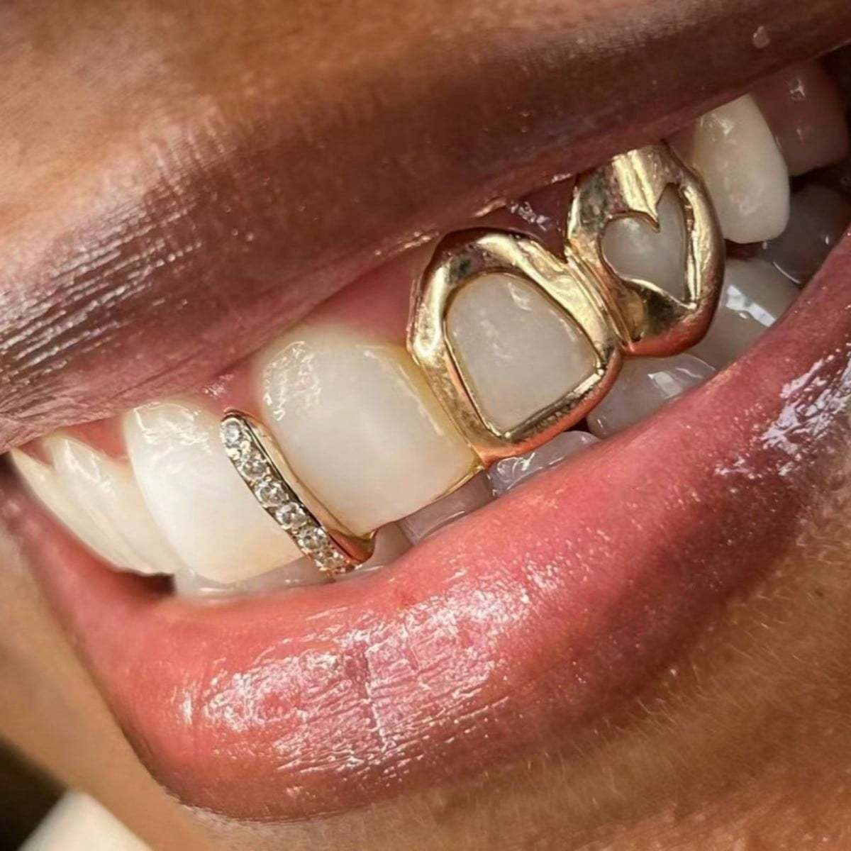 Grillz Hip-Hop Rock Hollow Love Stick Drill Double Braces Daily Out Cool Glossy Gold Teeth Hip Hop Versatile